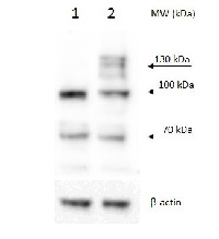 PRP40B | pre-mRNA-processing protein 40B in the group Antibodies Plant/Algal / DNA/RNA/Cell Cycle / RNA metabolism at Agrisera AB (Antibodies for research) (AS14 2785)